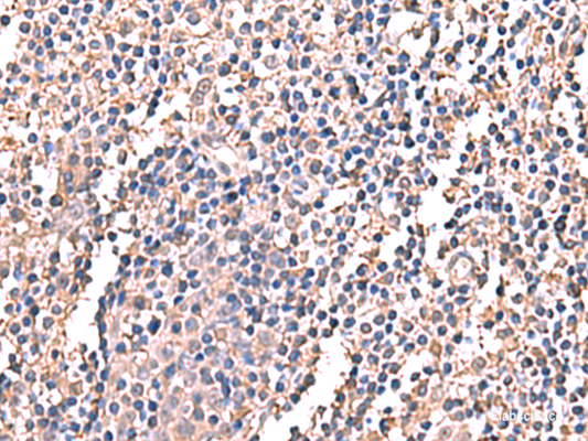 Immunohistochemistry of paraffin-embedded Human tonsil tissue  using LDHAL6B Polyclonal Antibody at dilution of 1:60(×200)