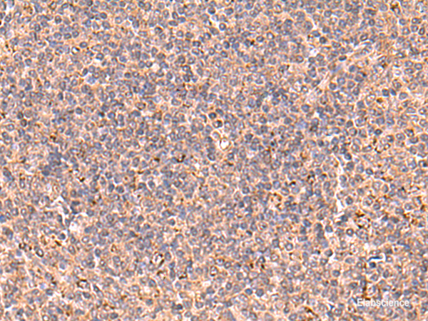 Immunohistochemistry of paraffin-embedded Human tonsil tissue  using UBAC1 Polyclonal Antibody at dilution of 1:60(×200)