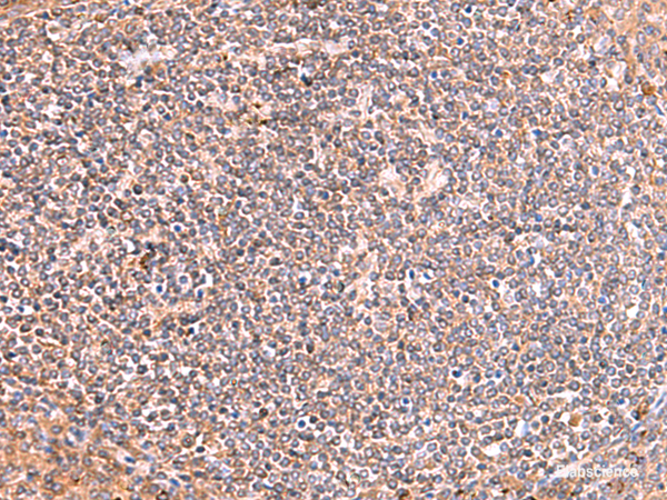 Immunohistochemistry of paraffin-embedded Human tonsil tissue  using PHKG2 Polyclonal Antibody at dilution of 1:60(×200)