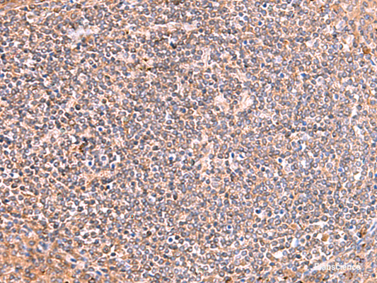Immunohistochemistry of paraffin-embedded Human tonsil tissue  using PHKG2 Polyclonal Antibody at dilution of 1:60(×200)