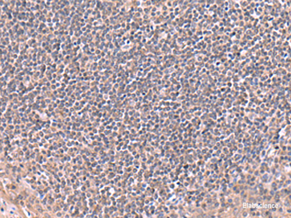 Immunohistochemistry of paraffin-embedded Human tonsil tissue  using RIC8A Polyclonal Antibody at dilution of 1:80(×200)