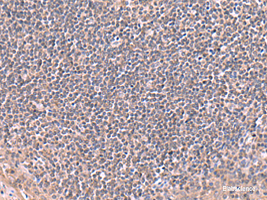 Immunohistochemistry of paraffin-embedded Human tonsil tissue  using RIC8A Polyclonal Antibody at dilution of 1:80(×200)
