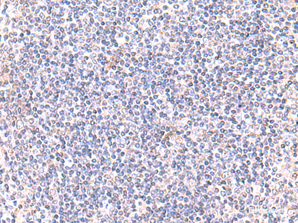 Immunohistochemistry of paraffin-embedded Human tonsil tissue  using IFT57 Polyclonal Antibody at dilution of 1:85(×200)