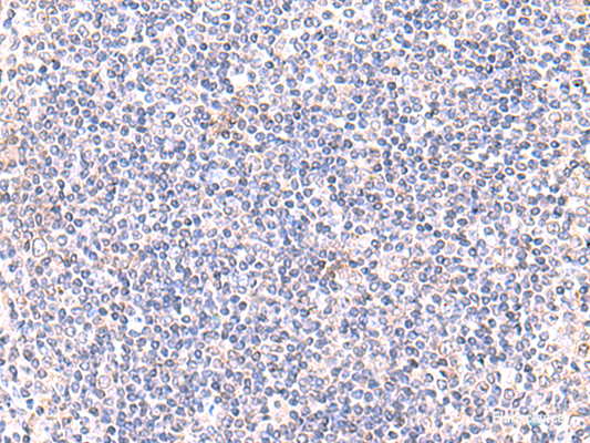 Immunohistochemistry of paraffin-embedded Human tonsil tissue  using IFT57 Polyclonal Antibody at dilution of 1:85(×200)
