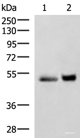 Western blot analysis of Human right lower lung tissue and Human plasma solution lysates  using SIGLEC6 Polyclonal Antibody at dilution of 1:650
