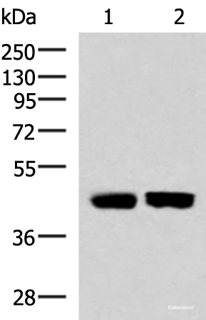 Western blot analysis of Human fetal liver tissue and Human liver tissue lysates  using KIR3DL1 Polyclonal Antibody at dilution of 1:1000