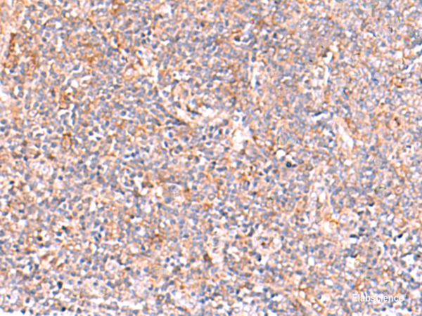 Immunohistochemistry of paraffin-embedded Human tonsil tissue  using NADK Polyclonal Antibody at dilution of 1:95(×200)