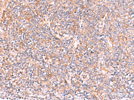 Immunohistochemistry of paraffin-embedded Human tonsil tissue  using NADK Polyclonal Antibody at dilution of 1:95(×200)