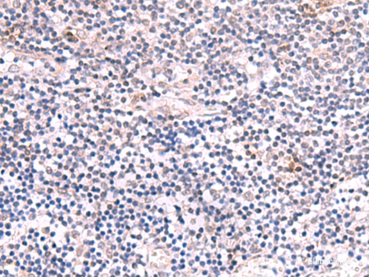 Immunohistochemistry of paraffin-embedded Human tonsil tissue  using INPP5K Polyclonal Antibody at dilution of 1:85(×200)