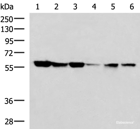 Western blot analysis of 293T 231 K562 Jurkat and Hela cell lysates  using FKBP4 Polyclonal Antibody at dilution of 1:700