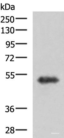 Western blot analysis of Human fetal brain tissue lysate  using TSEN2 Polyclonal Antibody at dilution of 1:1000