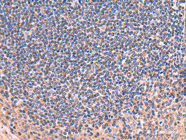 Immunohistochemistry of paraffin-embedded Human tonsil tissue  using ZNF256 Polyclonal Antibody at dilution of 1:70(×200)
