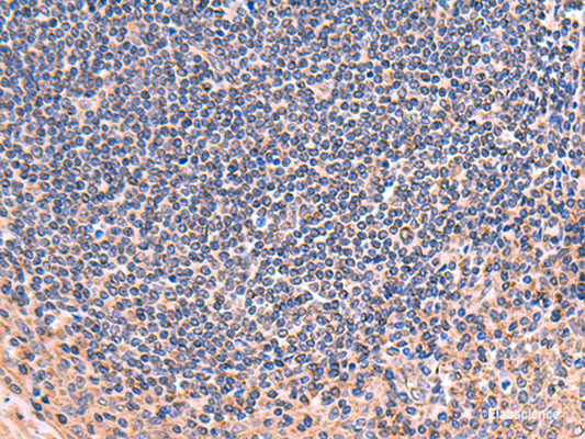 Immunohistochemistry of paraffin-embedded Human tonsil tissue  using ZNF256 Polyclonal Antibody at dilution of 1:70(×200)