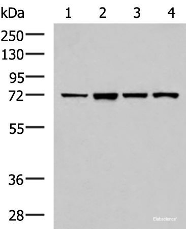Western blot analysis of Jurkat cell Mouse liver tissue HepG2 cell Mouse kidney tissue lysates  using ZAP70 Polyclonal Antibody at dilution of 1:800
