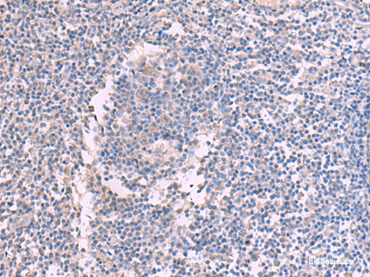 Immunohistochemistry of paraffin-embedded Human tonsil tissue  using CCT5 Polyclonal Antibody at dilution of 1:60(×200)