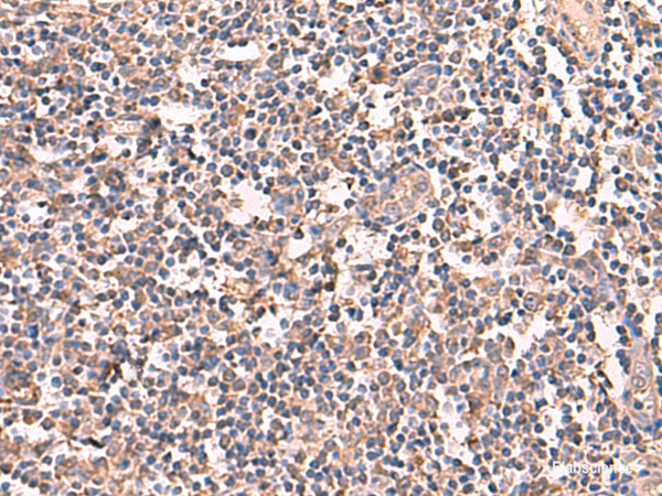 Immunohistochemistry of paraffin-embedded Human tonsil tissue  using RIOK1 Polyclonal Antibody at dilution of 1:60(×200)