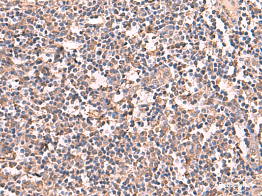 Immunohistochemistry of paraffin-embedded Human tonsil tissue  using RIOK1 Polyclonal Antibody at dilution of 1:60(×200)