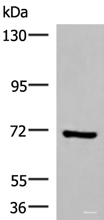 Western blot analysis of HepG2 cell lysate  using PAPSS2 Polyclonal Antibody at dilution of 1:1000