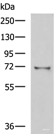 Western blot analysis of Mouse kidney tissue lysate  using GSTCD Polyclonal Antibody at dilution of 1:1000