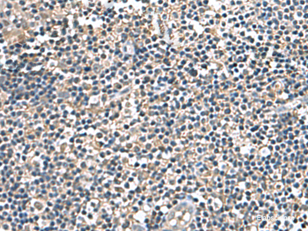 Immunohistochemistry of paraffin-embedded Human tonsil tissue  using IP6K2 Polyclonal Antibody at dilution of 1:140(×200)