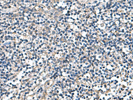 Immunohistochemistry of paraffin-embedded Human tonsil tissue  using DPY19L3 Polyclonal Antibody at dilution of 1:110(×200)