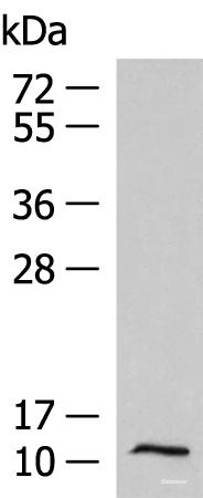 Western blot analysis of Human fetal liver tissue lysate  using PCBD1 Polyclonal Antibody at dilution of 1:1000