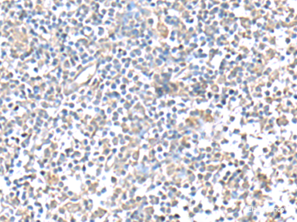 Immunohistochemistry of paraffin-embedded Human tonsil tissue  using IFI27 Polyclonal Antibody at dilution of 1:80(×200)