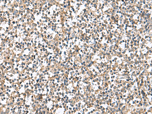 Immunohistochemistry of paraffin-embedded Human tonsil tissue  using PTPRS Polyclonal Antibody at dilution of 1:110(×200)