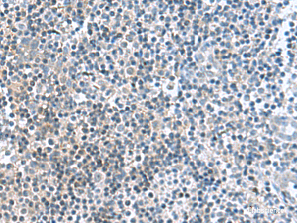 Immunohistochemistry of paraffin-embedded Human tonsil tissue  using FAM107B Polyclonal Antibody at dilution of 1:160(×200)