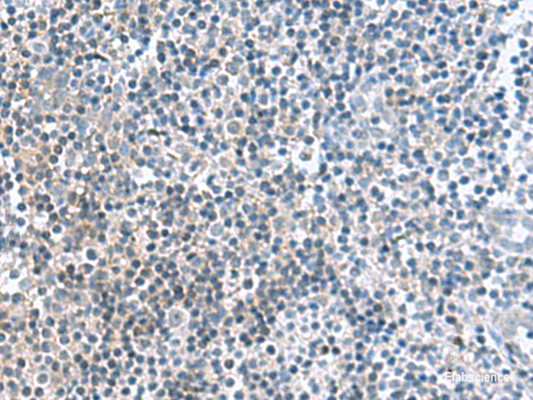 Immunohistochemistry of paraffin-embedded Human tonsil tissue  using FAM107B Polyclonal Antibody at dilution of 1:160(×200)