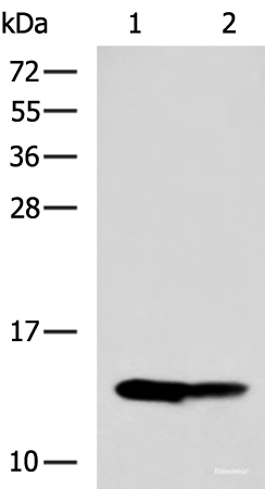 Western blot analysis of Mouse liver tissue and Mouse kidney tissue lysates  using RIDA Polyclonal Antibody at dilution of 1:650