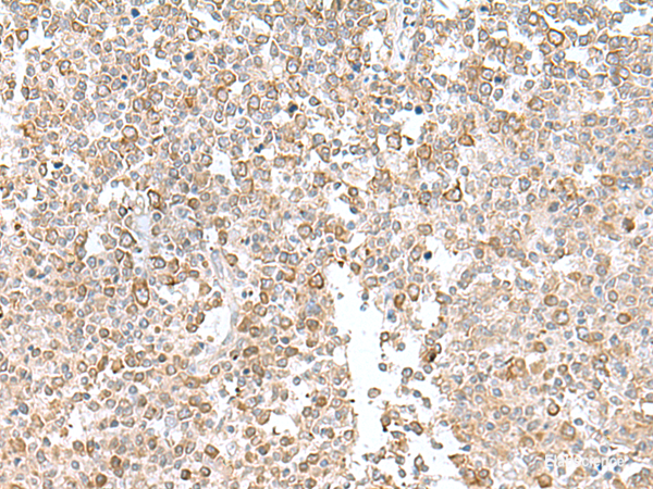 Immunohistochemistry of paraffin-embedded Human tonsil tissue  using EIF1AY Polyclonal Antibody at dilution of 1:55(×200)