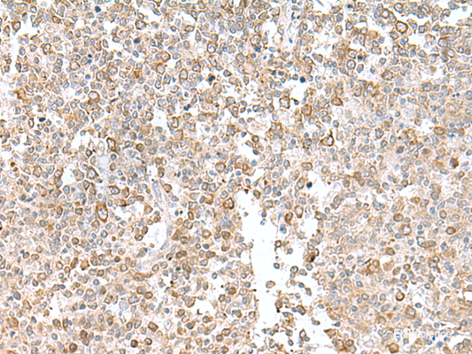 Immunohistochemistry of paraffin-embedded Human tonsil tissue  using EIF1AY Polyclonal Antibody at dilution of 1:55(×200)