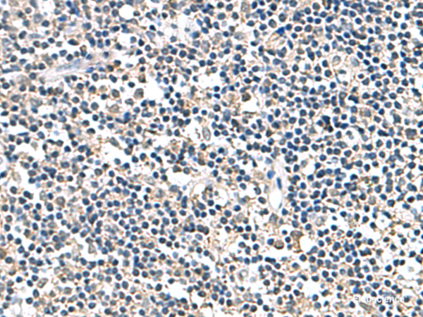 Immunohistochemistry of paraffin-embedded Human tonsil tissue  using ATP5F1D Polyclonal Antibody at dilution of 1:80(×200)