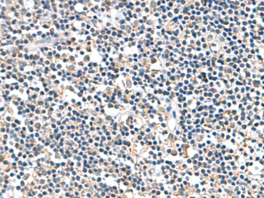 Immunohistochemistry of paraffin-embedded Human tonsil tissue  using ATP5F1D Polyclonal Antibody at dilution of 1:80(×200)