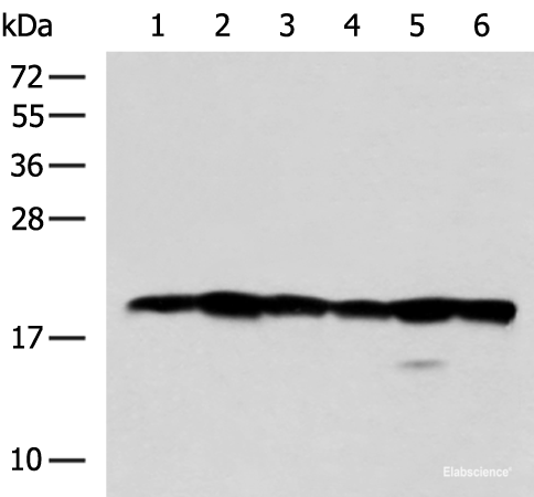 Western blot analysis of 293T Jurkat Hela and 231 cell lysates  using BLOC1S6 Polyclonal Antibody at dilution of 1:600
