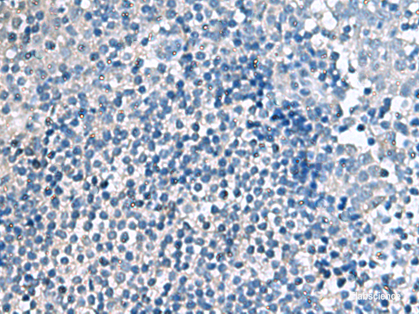 Immunohistochemistry of paraffin-embedded Human tonsil tissue  using EIF4A2 Polyclonal Antibody at dilution of 1:70(×200)