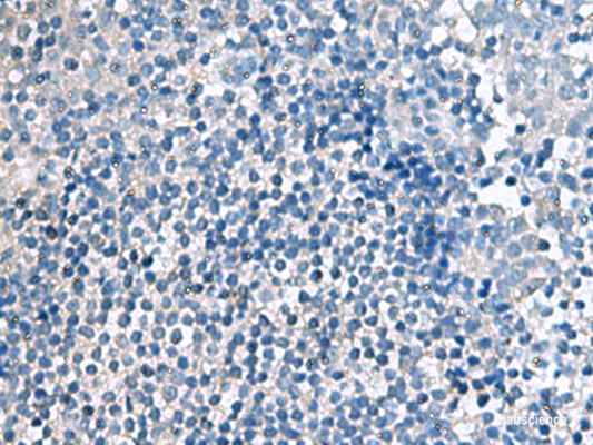 Immunohistochemistry of paraffin-embedded Human tonsil tissue  using EIF4A2 Polyclonal Antibody at dilution of 1:70(×200)
