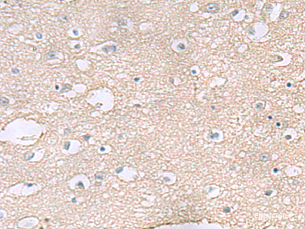 Immunohistochemistry of paraffin-embedded Human brain tissue  using TAGLN3 Polyclonal Antibody at dilution of 1:60(×200)