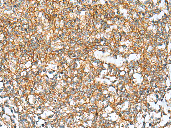 Immunohistochemistry of paraffin-embedded Human tonsil tissue  using RAB13 Polyclonal Antibody at dilution of 1:50(×200)