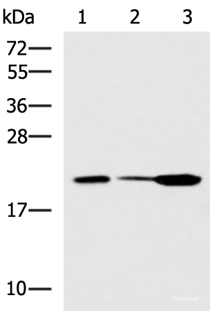 Western blot analysis of Mouse small intestines tissue Mouse kidney tissue Mouse pancreas tissue lysates  using PPIC Polyclonal Antibody at dilution of 1:550