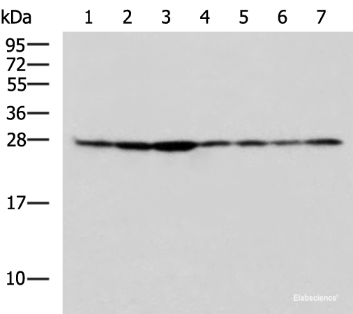 Western blot analysis of HepG2 Hela Jurkat HUVEC cell Mouse lung tissue Mouse kidney tissue Rat liver tissue lysates  using RPL10A Polyclonal Antibody at dilution of 1:700