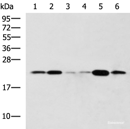 Western blot analysis of Raji Hela cell Mouse liver tissue Rat lung tissue Mouse Pancreas tissue NIH/3T3 cell lysates  using TMED10 Polyclonal Antibody at dilution of 1:800
