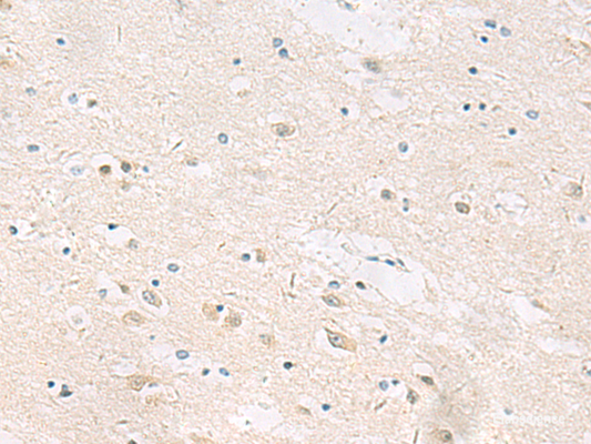 Immunohistochemistry of paraffin-embedded Human brain tissue  using ANKS6 Polyclonal Antibody at dilution of 1:55(×200)
