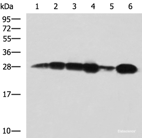 Western blot analysis of 293T cell Human bladder transitional cell carcinoma grade 2-3 tissue lysate MCF-7 cell lysates  using MMAB Polyclonal Antibody at dilution of 1:1400