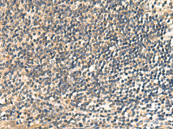 Immunohistochemistry of paraffin-embedded Human tonsil tissue  using CNST Polyclonal Antibody at dilution of 1:60(×200)