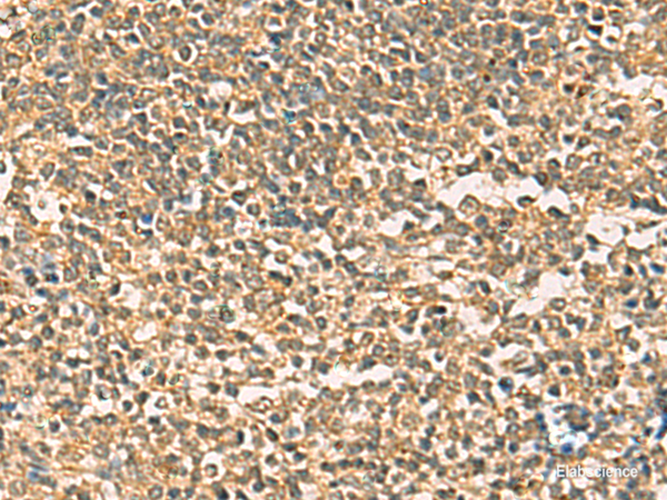 Immunohistochemistry of paraffin-embedded Human tonsil tissue  using THG1L Polyclonal Antibody at dilution of 1:50(×200)