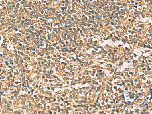 Immunohistochemistry of paraffin-embedded Human tonsil tissue  using THG1L Polyclonal Antibody at dilution of 1:50(×200)