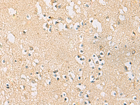 Immunohistochemistry of paraffin-embedded Human brain tissue  using PDE4DIP Polyclonal Antibody at dilution of 1:45(×200)