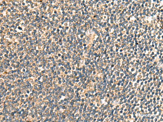 Immunohistochemistry of paraffin-embedded Human tonsil tissue  using PRKRA Polyclonal Antibody at dilution of 1:60(×200)
